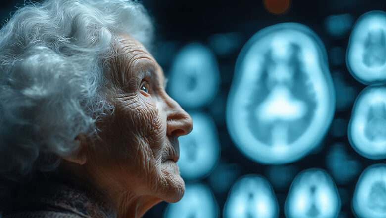 Alzheimer-Gesellschaft soll gegründet werden